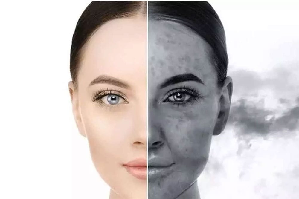 مراقبت-از-پوست-در-هوای-الوده